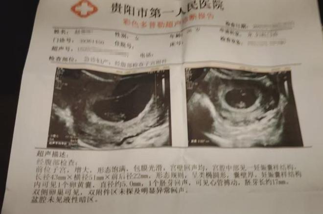 期孕妇担忧：害怕美味成“隐患”PG电子麻